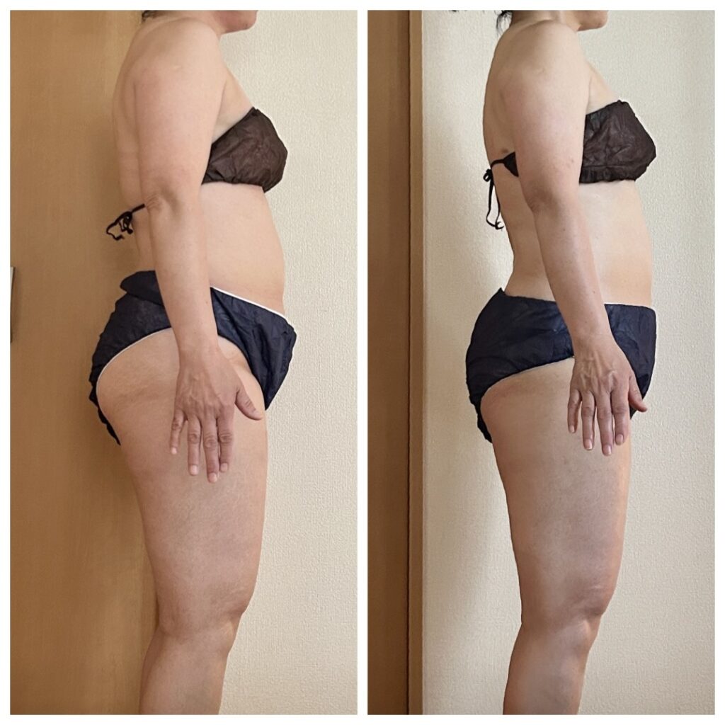 宇都宮でダイエットコース_リンパマッサージを受けた結果