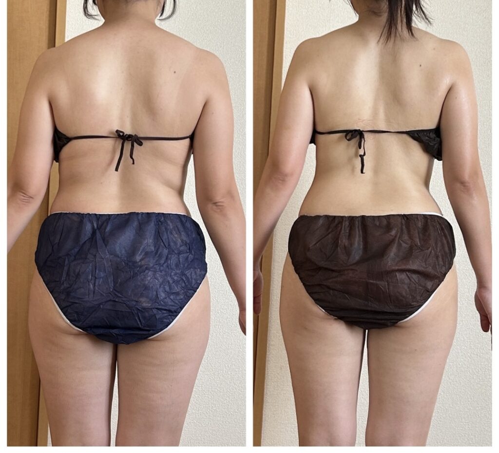 宇都宮の痩身リンパマッサージ_ダイエットメニュー